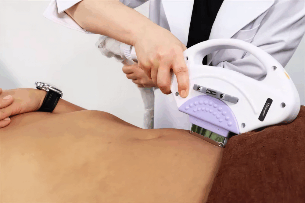 やさしい照射で、痛みを抑えた脱毛体験