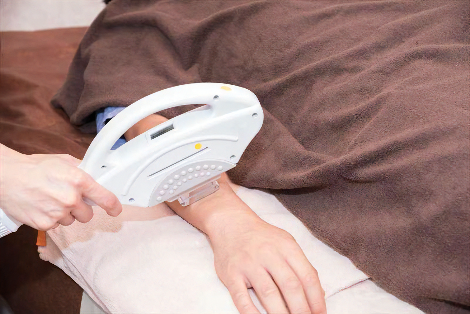 年齢によるムダ毛の変化にも対応